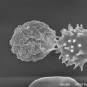 Globule rouge infecté par Plasmodium falciparum - © Institut Pasteur/Sylvie Perrot