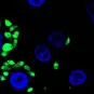 Leishmania : un parasite qui s’adapte à son environnement par amplification chromosomique - Institut Pasteur