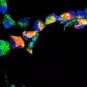 Comment le virus Zika induit la microcéphalie congénitale