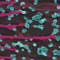Cellules infectées - Institut Pasteur