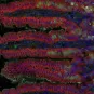 listeria - institut pasteur