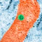 Fiches maladies - Dengue - Institut Pasteur