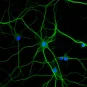 Comment la nicotine agit sur le cerveau des schizophrènes 