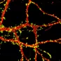 Microscopie d'un neurone.
