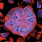 Mooc Malaria Institut Pasteur - Fun