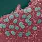 actéries Neisseria meningitidis adhérant à la surface de cellules épithéliales. Les diplocoques sont enchevêtrés dans des microvillosités d'origine cellulaires. 