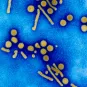Viruses and  Human Cancers