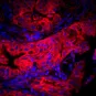 Cancer Initiative at Institut Pasteur