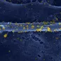 Une protéine essentielle à la réplication du virus chikungunya identifiée