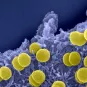Méningites à méningocoques - Institut Pasteur