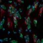 Chlamydia trachomatis - Institut Pasteur