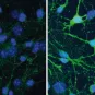 La dépression et l’efficacité des antidépresseurs dépendent de la composition du microbiote intestinal - Institut Pasteur