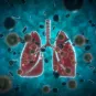 Covid-19 - poumons - lung - Institut Pasteur