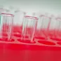 COVID-19 : un projet vaccin lentiviral par voie intra-nasale assure une protection importante chez l’animal
