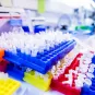 Surveillance des facteurs de risque COVID-19 chez les personnels de santé africains : une étude mise en place via le projet MediLabSecure