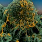 Cellules bronchiques humaines infectées par SARS-CoV-2