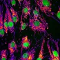 Brain connectivity and neurodegenerative diseases - Institut Pasteur