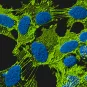 Brain connectivity and neurodegenerative diseases - Institut Pasteur