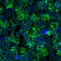 Nouvelle découverte sur les récepteurs d’entrée des coronavirus dans les cellules humaines 