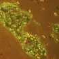 Cryptococcus neoformans dans un abcès du cerveau © Institut Pasteur/Françoise Dromer