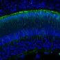 Coloration d'un oeil embryonnaire de souris - Institut Pasteur