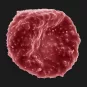  Globule rouge parasité par Plasmodium falciparum - Institut Pasteur