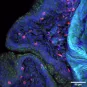 bladder