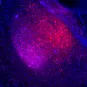 Dépression : un dysfonctionnement de certains neurones de l’amygdale serait à l’origine de la perception négative de l’environnement 