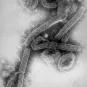 Image de microscopie électronique à transmission révélant une partie de la morphologie ultrastructurale présentée par un certain nombre de virions du virus Marburg