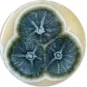 aspergillose