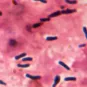 Corynebacterium diphteriae (ou bacille de Klebs et Loeffler)