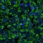 Tissu respiratoire humain, avec les cellules ciliées marquées en vert (anticorps anti-TMPRSS2), noyaux en bleu foncé, membranes cellulaires en bleu clair. 