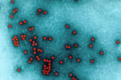 Entérovirus et Vaccins viraux - Institut Pasteur