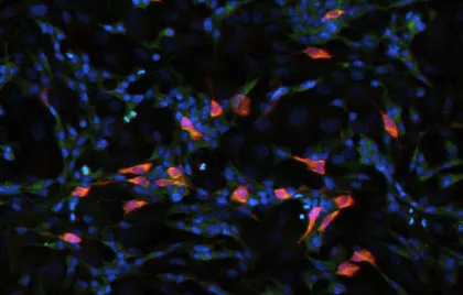 Bactéries résistantes aux antibiotiques - Institut Pasteur