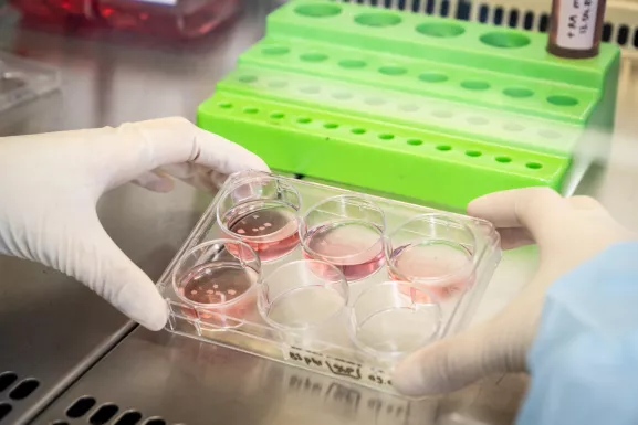 Culture d’organoïdes cérébraux dans l'unité Mécanismes moléculaires du vieillissement Pathologique et Physiologique. Ces organoïdes sont issus de cellules souches pluripotentes (cellules IPS) qui vont se différencier et se structurer pour reproduire in vitro une micro-anatomie.