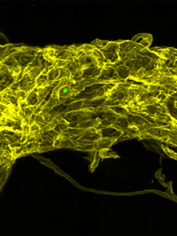 Cette étude vise à créer un nouveau modèle d'infection par Toxoplasma gondii chez la drosophile. Nous montrons ici que la barrière hémato-encéphalique, représentée en jaune, du cerveau larvaire est altérée 24 heures après l'infection par ce parasite, représenté en vert.