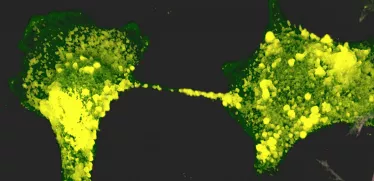 Le SARS-CoV-2 (en jaune) se propage à travers les nanotubes