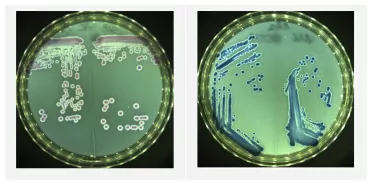 Citrobacter et Serratia forment des colonies de couleur bleue